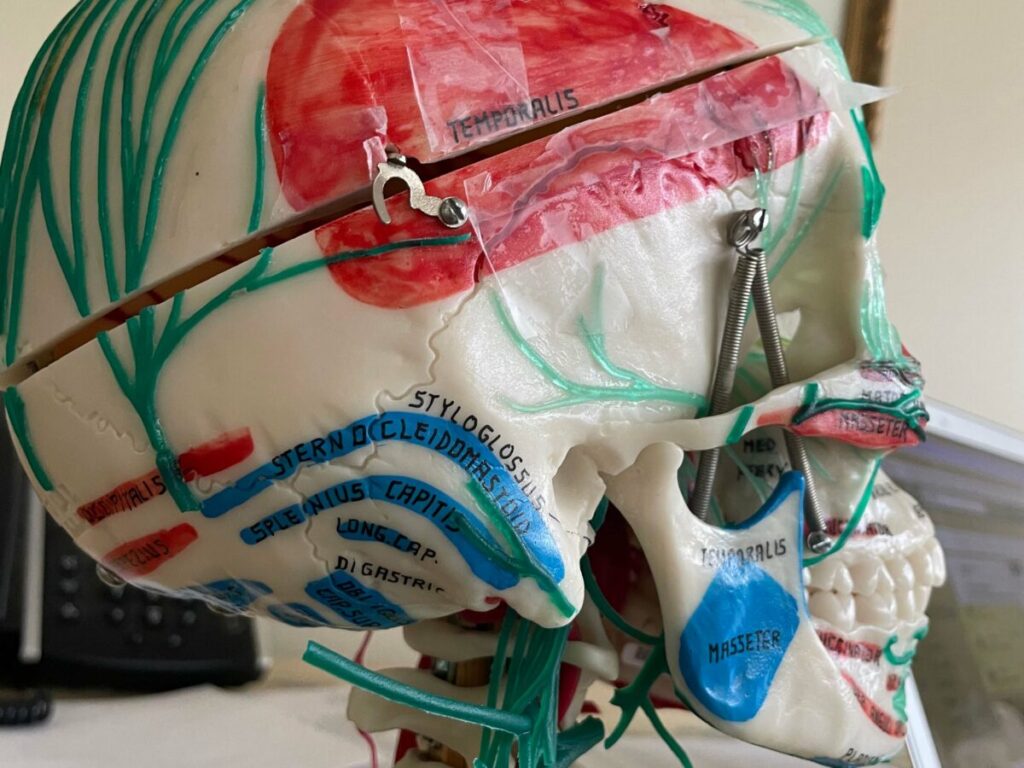 Dry Needling, Trigger Point Injections, and Botox