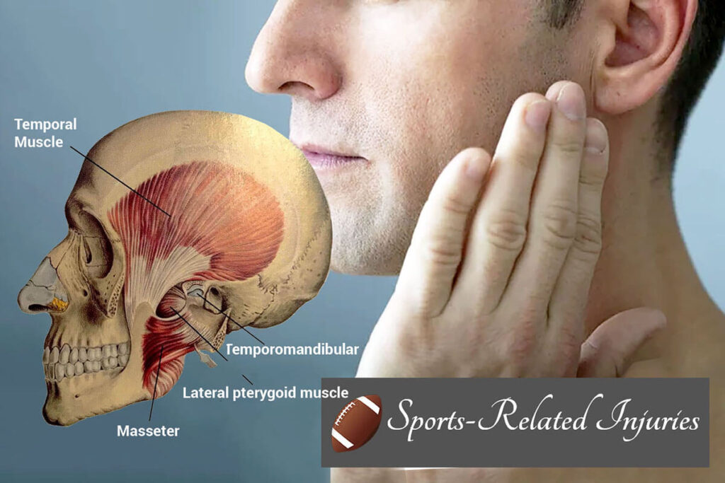 Sports-Related Injuries and TMJ